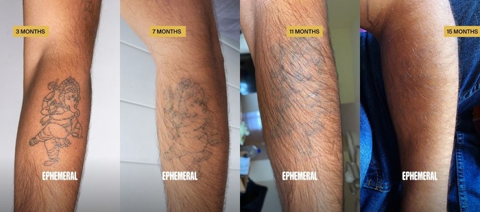 Are Ephemeral Tattoos Worth The Hype